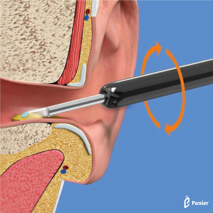 Nettoyeur D’oreille Endoscopique Sans Fil Et Usb Avec Caméra À Connecter En Wifi